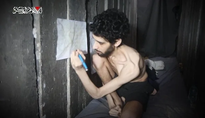 Here’s What a Hostage, and Real Hunger, Look Like
