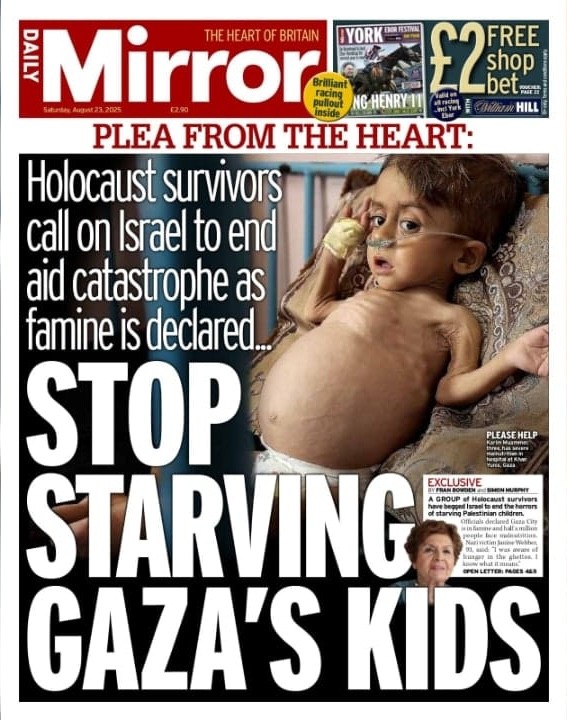 NextImg:Another ‘Starving Gazan’ Suffering From a Congenital Illness