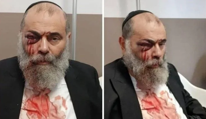 NextImg:Another Day, Another Jew Assaulted in Europe and Beaten Bloody